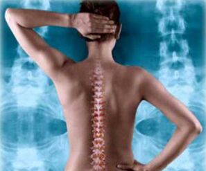 rug wervelkolom illustratie