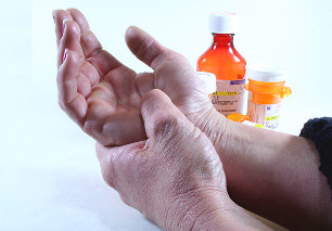 methoden voor het behandelen van artritis en artrose