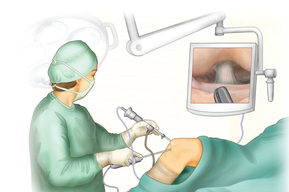 Knie operatie