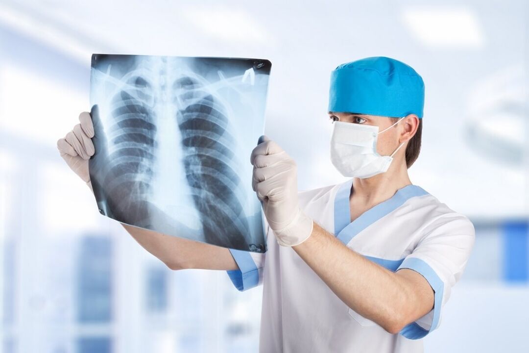 Röntgenfoto van de borst met osteochondrose