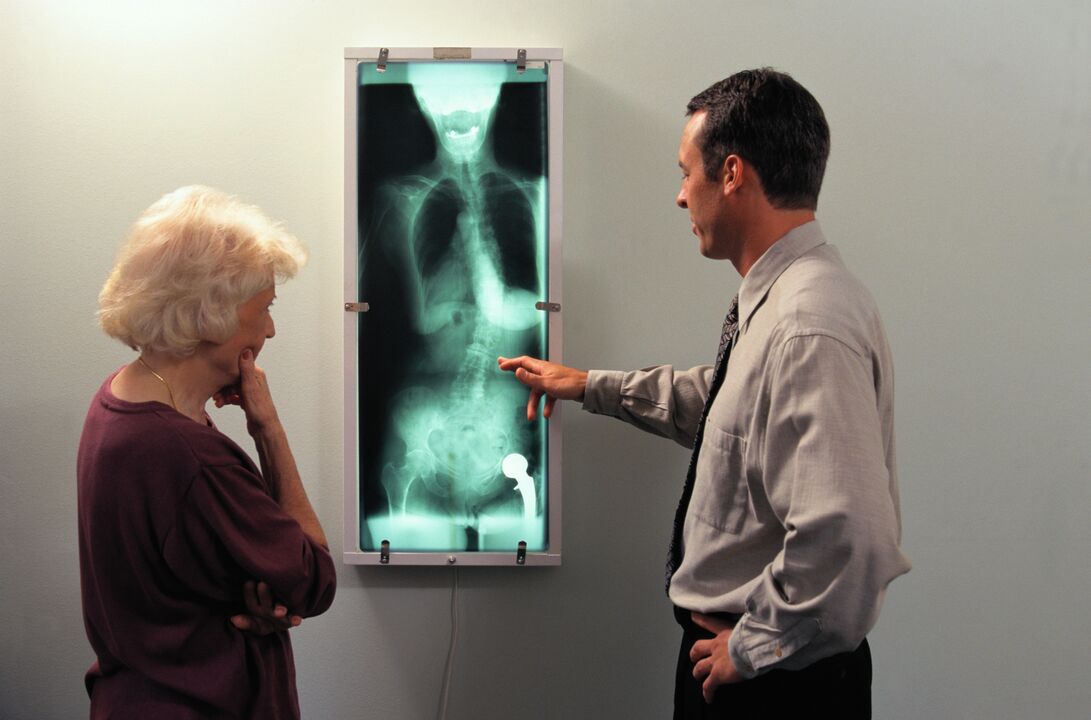 röntgendiagnose voor pijn in het heupgewricht