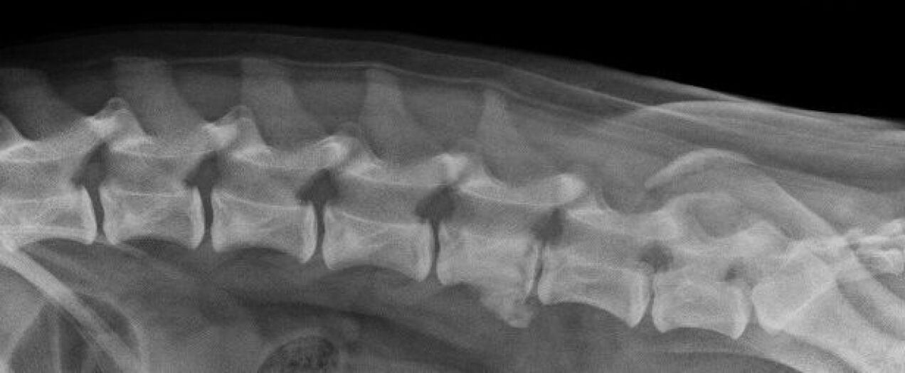 Manifestaties van osteochondrose van de thoracale wervelkolom op een röntgenfoto