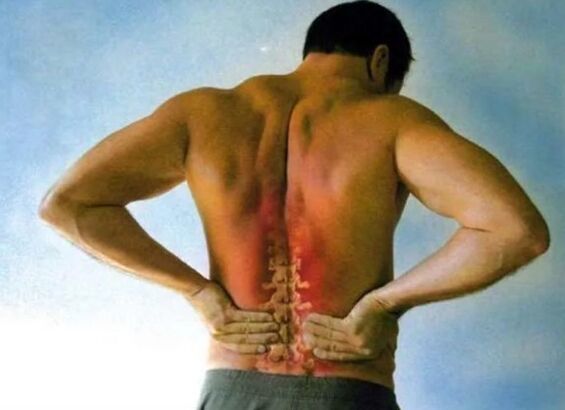 Pijn voor lumbale osteochondrose